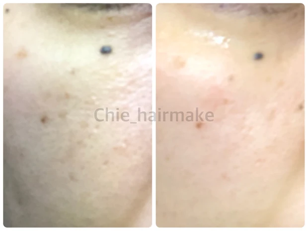 リピート決定?!ツヤ肌になる美容液。1ヶ月使ってみました。
_2