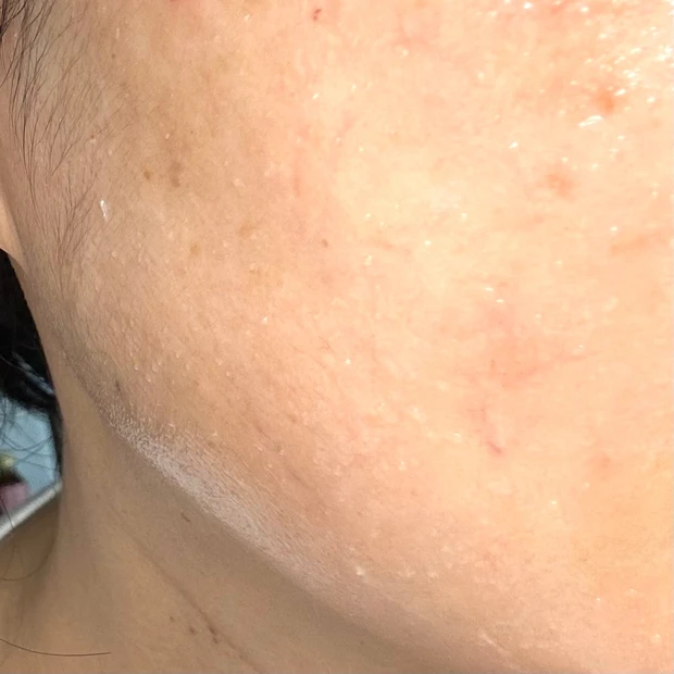 真夏の毛穴対策は一本三役のこんにゃくスクラブで優しく「スリール 」3Way毛穴マイルドスクラブ_3_2