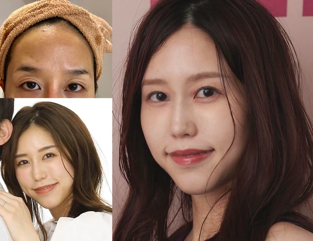 美容課金 小顔矯正