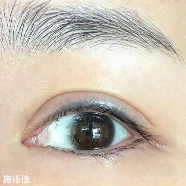 アートメイク アイライン chisaさん