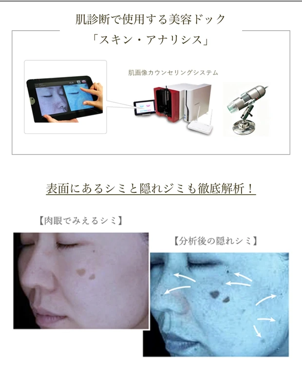 【30代で美容医療デビュー!】私が「初めての美容医療」に選んだクリニックの選択理由とその感想をレポートします!_7