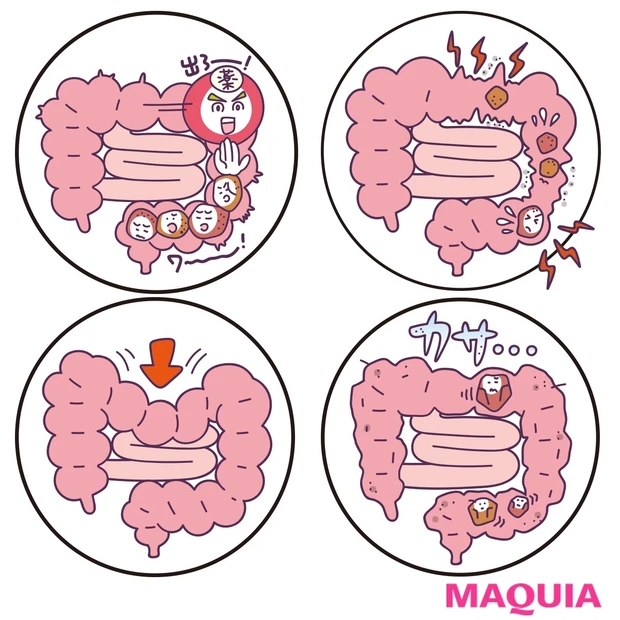 あなたの便秘はどのタイプ？ 出ない理由を生活習慣別に診断！ 解消法も教え…