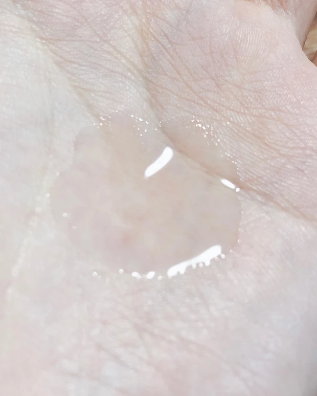 【絶対跡残さない！】肌荒れ対策、ニキビ跡ケア5選_3_2