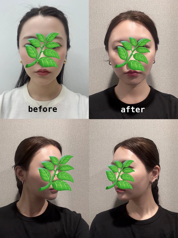 【自己紹介】マキアインフルエンサー1年目の「あち」です！ これからアラサーのリアルな肌管理やメイク、韓国美容について発信していきます♡_4_2