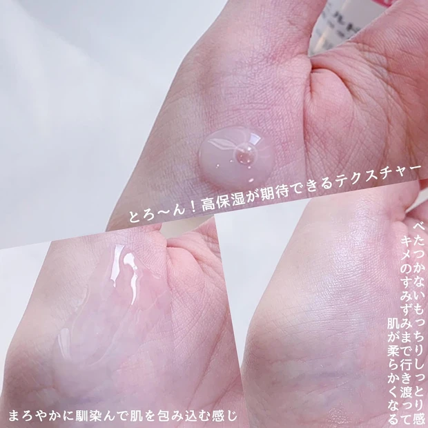 あのヒルドイドがついにデビュー!早速高保湿化粧水を使ってみました_2