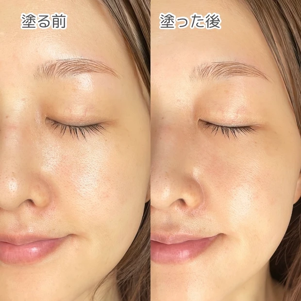 KOPHER　コフェル　キュリペア メラクリーム　レビュー　肌荒れ　スキンケア