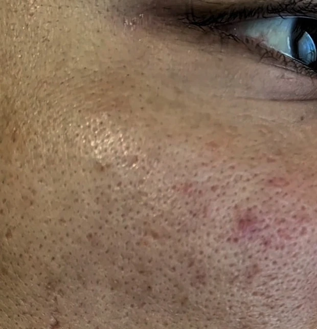 【アラサー独身男の実体験】この時期！特に気になる毛穴ケアに注目👀_2