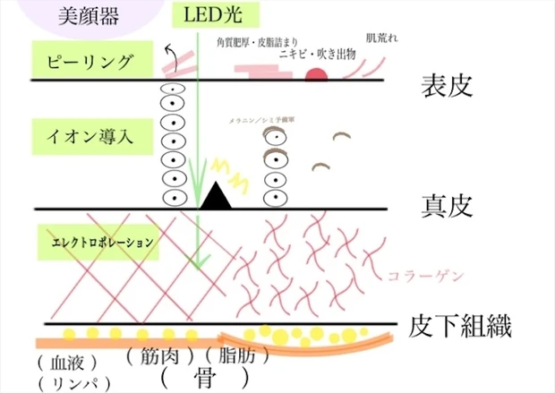 美顔器の特徴