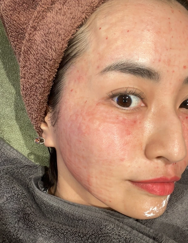 私が実践する【投資美容】3選！_1_2