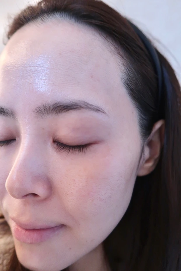 【ドクターズコスメを組み合わせた超美白ケア】_10_2