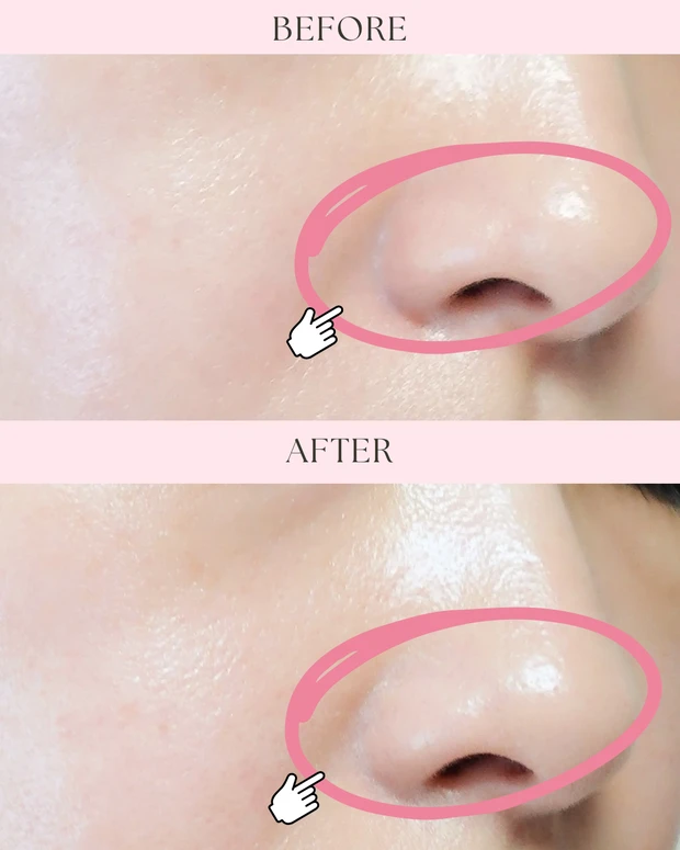 エレガンス モデリング カラーベース GR400を使用したビフォーアフター比較画像。ビフォーでは小鼻の赤みが目立ち、アフターではグリーン下地で赤みが自然に補正され、清潔感のある澄んだ肌印象に仕上がっている。