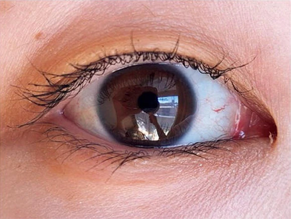 マジョリカ マジョルカ ラッシュエキスパンダー 孔雀ロングのスウォッチ After