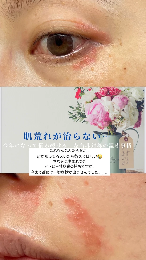 【Who is beki?】5年目ブロガーbekiが目指すは『カラダの中からキレイな人』づくり♡_3