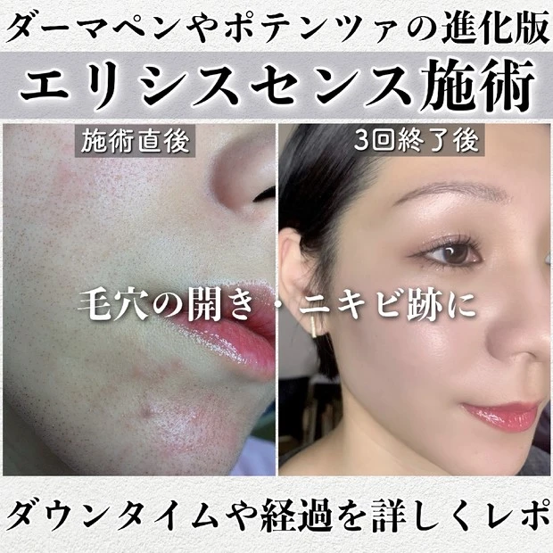 【2月ベストクリップ賞発表】X(旧Twitter)の活用についてもご紹介!_4