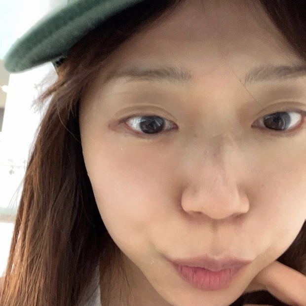 【韓国美容医療①】プムグローバル江南でポテンツァ＆ボトックス体験レポ！_12_2