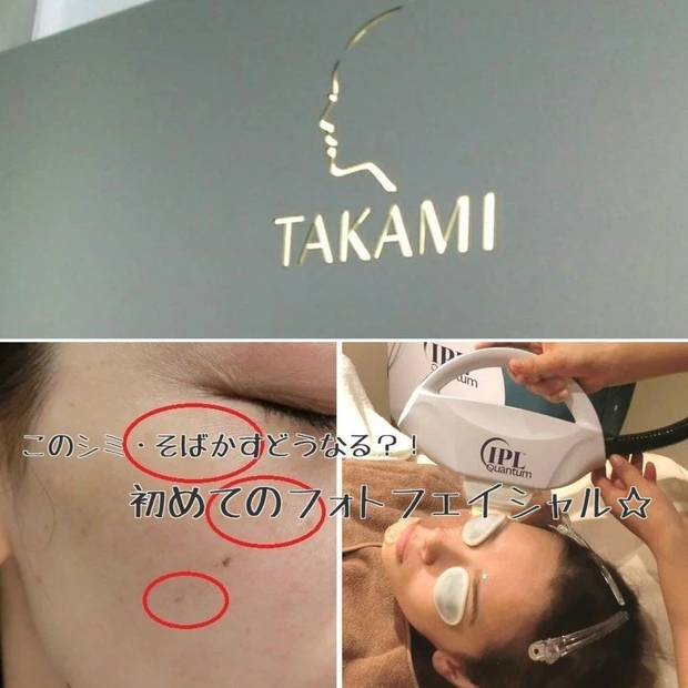 ついにフォトフェイシャル・デビュー★タカミ式フォトフェイシャルってこんな感じ編