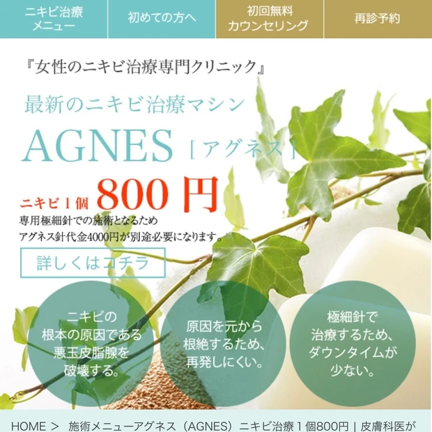 治らない　皮膚科　治し方　原因　アグネス　大人ニキビ　繰り返す大人ニキビ　フェイスラインのニキビ　ニキビ　しつこいニキビ　ニキビ辛い　ニキビのストレス