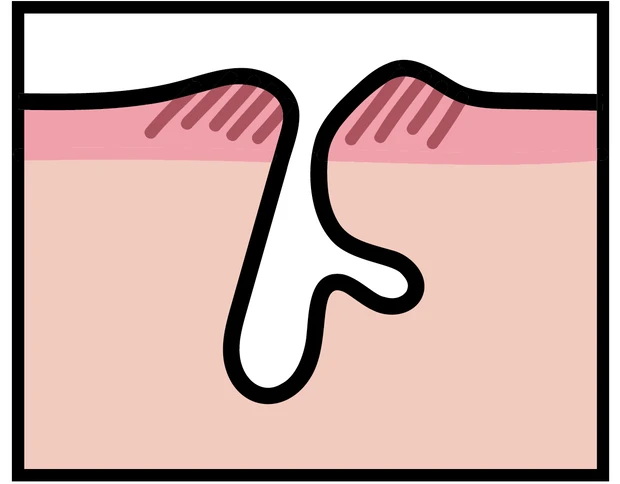 【悩み別】毛穴を目立たなくする方法 PhotoGallery_1_8