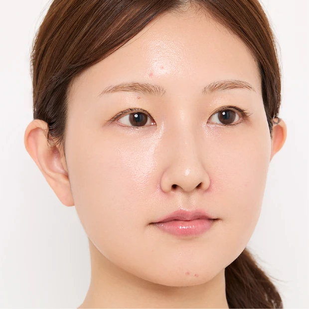 マキアインフルエンサー なーこさん 赤み&ニキビ悩み ヘア&メイク 小澤桜 プチプラコスメ お悩み カバーメイク ベースメイク 赤み ニキビ 2026春新作