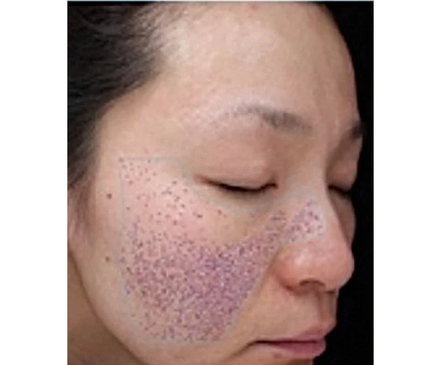 【夏の冷スキンケア】朝・昼・夜におすすめのスキンケアアイテム PhotoGallery_1_6