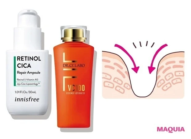 先手はコラーゲンケア、後手はリフトアップ! 友利 新先生が教える、たるみ毛穴管理テク