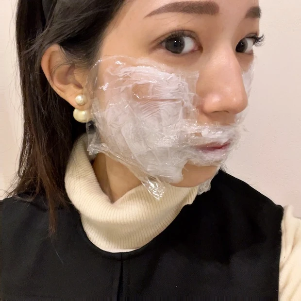 【韓国美容】韓国旅行で行ったクリニックをご紹介♡大満足の施術は...?_3