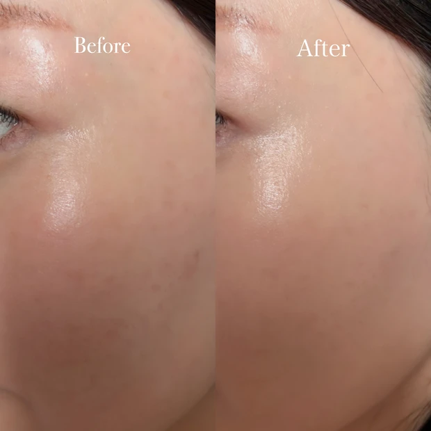 美容液ファンデ カバー力