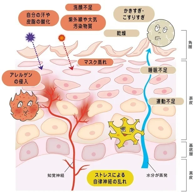 敏感肌の治安悪化のメカニズム