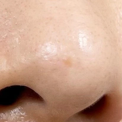 スポットシミケアを２種比較。できちゃったシミにも効くの？答えはYES!!_3_2