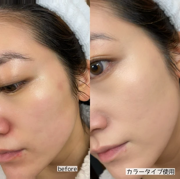 ドクターフィル　フイルナチュラント エクスバリア プロテクトリペアバーム　保護バーム　お守りスキンケア　スキンケア　ベースメイク　ファンデーション　プロテクトリペアバーム