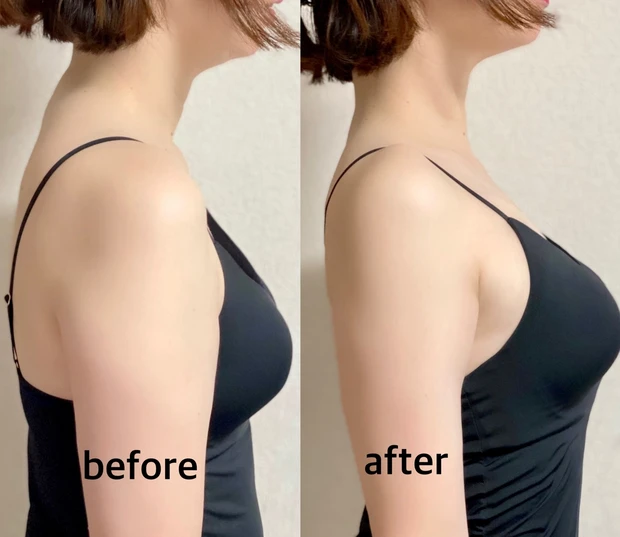 首・肩痩せストレッチビフォーアフター