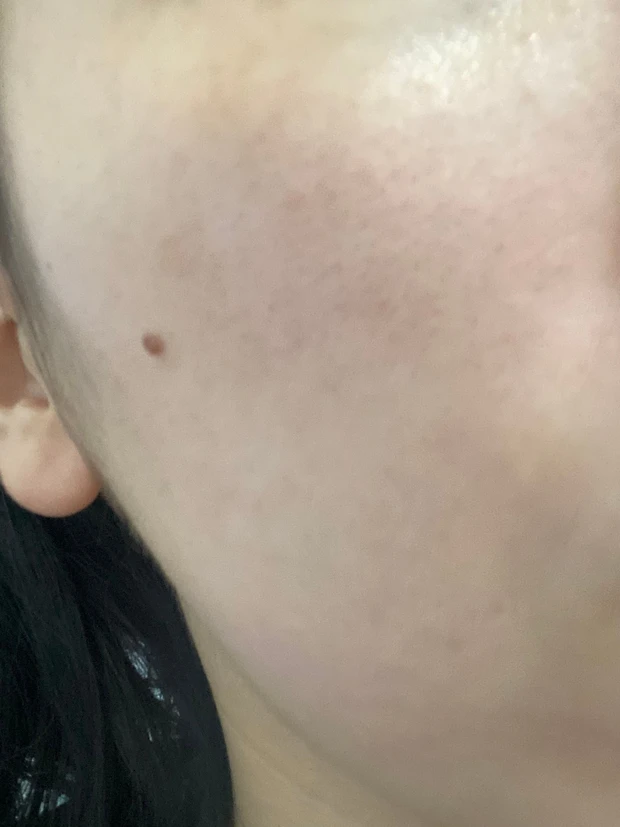 オバジ　オバジC25セラム NEO 美容液　ビタミンC