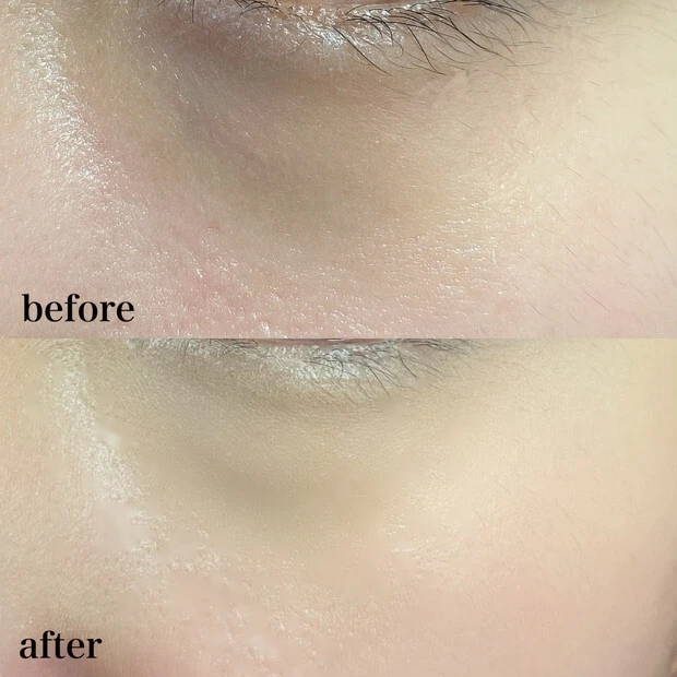 コスメデコルテ コンシーラー トーンパーフェクティング パレットりっちゃんインフルエンサーbeforeafter