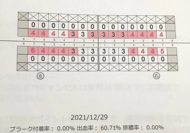 【デンタルケア】歯のクリーニング「エアーフロー」がすごい!年末年始は白い歯で過ごそう_3