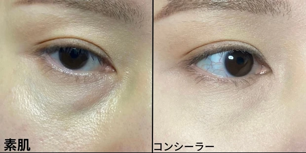 青くまさんに悩んでる人に捧げる！悩んでたら1度は試して欲しい！_2