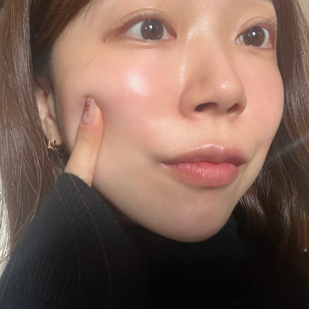 Luvum(ラビューム) ビタミンCゲルマスク 使用後のツヤ肌