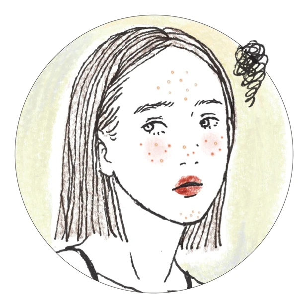 とっさの夏ニキビセルフケア！顎・口まわりの白ニキビ、悪化させない方法は？…