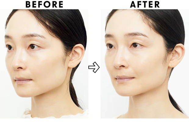 高額スキンケアの効果は？ ベスコス受賞コスメを2週間お試し PhotoGallery_1_24