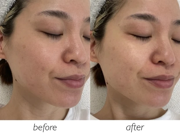 「ハウスオブローゼ シャーベットローション」ビフォーアフター