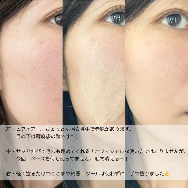 イニクス iniks 敏感肌 肌荒れ 毛穴カバー パウダリー 摩擦レス スキンフィット 低刺激