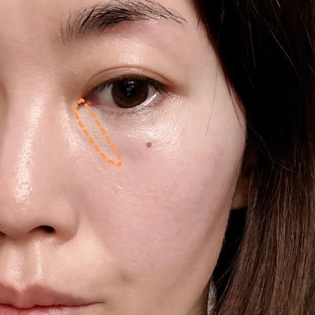 クマ隠しメイク