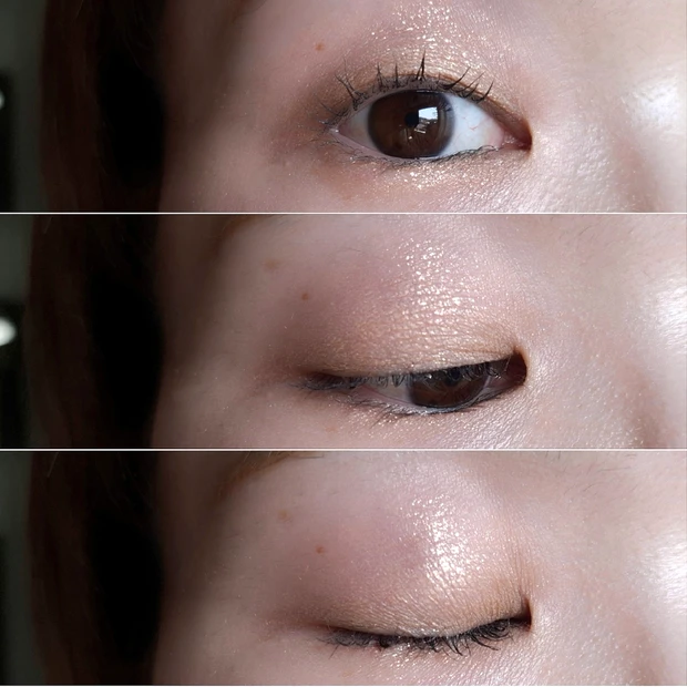 スパークルフラッシュ