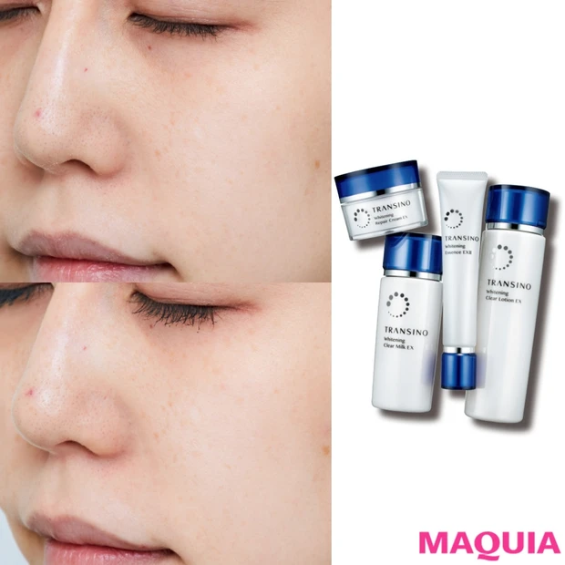 「白くなった」と言われるほどのパワー! トランシーノ美白ラインの30日間…