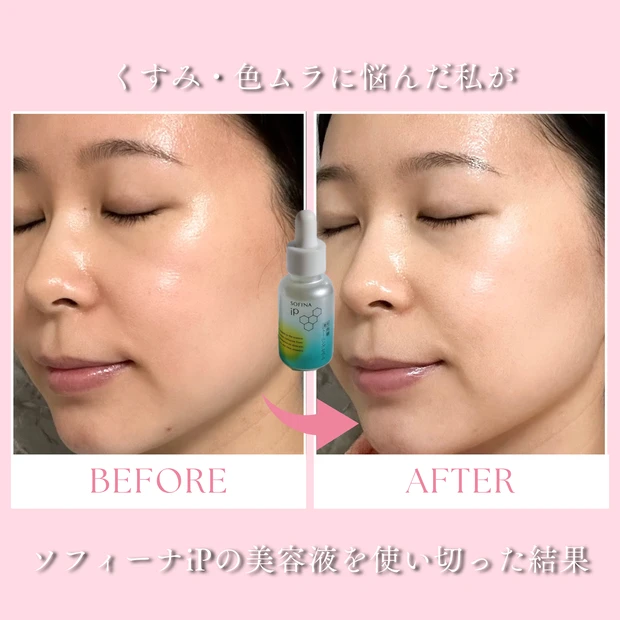 ソフィーナiP角層トーニングセラムの使い切りレビュー|くすみ・色ムラ改善の変化を紹介