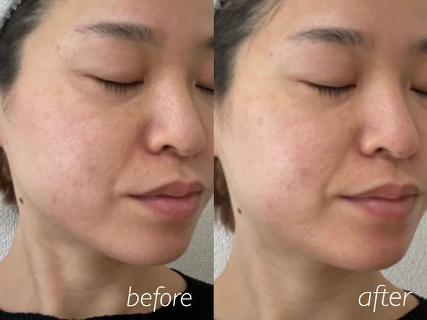 ルルンプレシャス GREEN ビフォーアフター