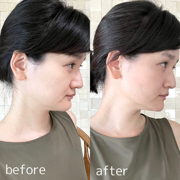 YA-MAN　スカルプリフトアクティブ ビフォーアフター