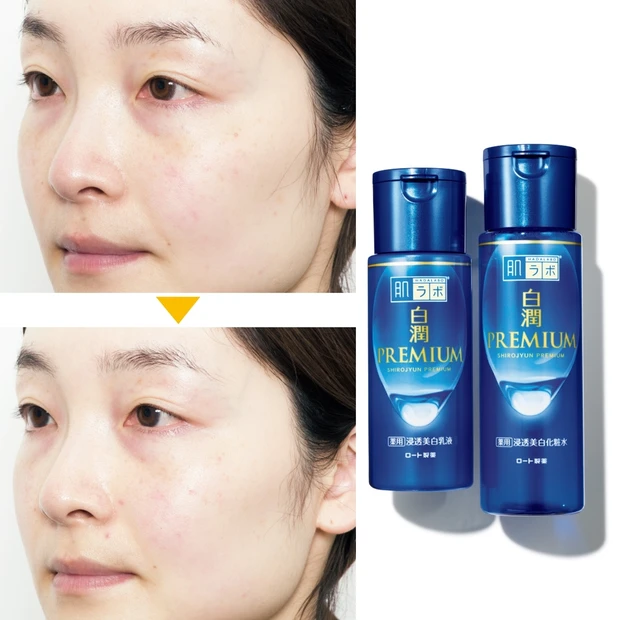 「肌ラボ 白潤プレミアム」を30日間使ってみたら…小ジワ55％改善！【ブ…