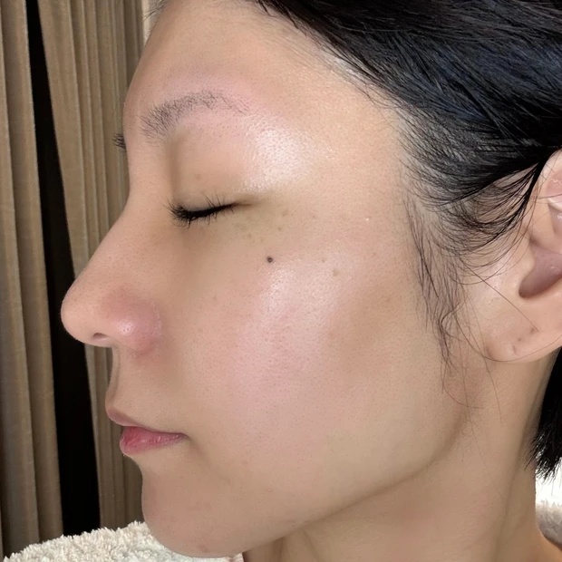 エリシスセンス ダウンタイム 14日目 経過