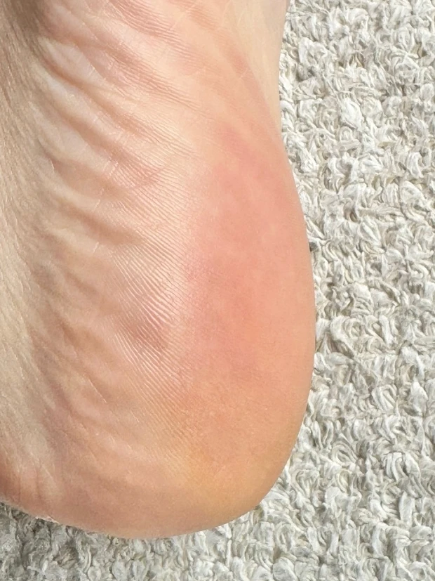 【検証】オルビスのディフェンセラでガサガサかかとがつるんとなるまでの4ヶ月を記録！_4_3