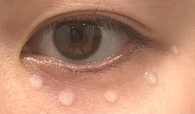 【ディオール】目元&ほうれい線にも！まるで塗る美容医療と言われる、「ヒアルロン酸補充」美容液【カプチュールトータル ヒアルショット】_4